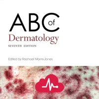 ABC of Dermatology